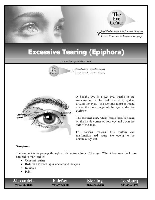 Ephiphora: What Causes Teary Eyes?