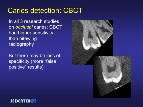 SEDENTEXCT: Guidelines and evidence-based use of CBCT