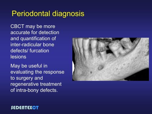 SEDENTEXCT: Guidelines and evidence-based use of CBCT