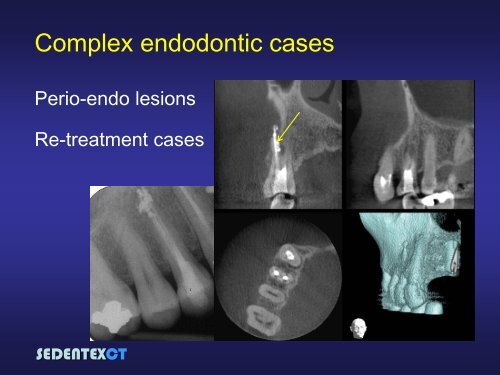 SEDENTEXCT: Guidelines and evidence-based use of CBCT