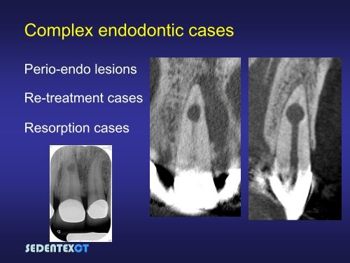 SEDENTEXCT: Guidelines and evidence-based use of CBCT