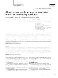 Alopecia areata difusa: uma forma atÃ­pica muitas ... - edigraphic.com