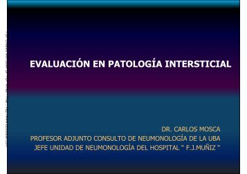 EvaluaciÃ³n de las intersticiopatias - SMIBA