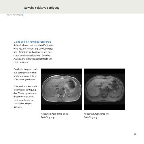 Magnete, Fluss und Artefakte - Siemens Healthcare