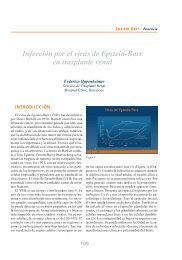 Infección por el virus de Epstein-Barr en trasplante renal - Roche ...