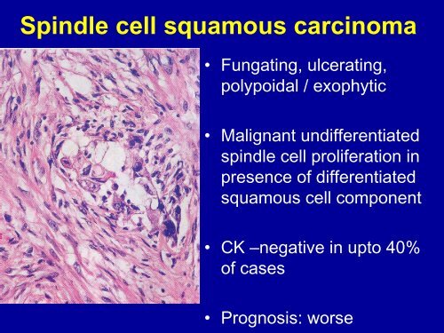 Pathology of Head and Neck Malignancies - Aroi.org