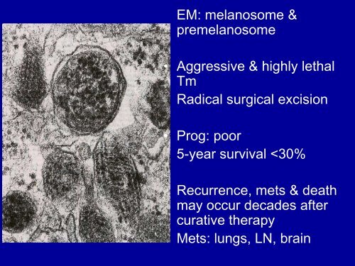 Pathology of Head and Neck Malignancies - Aroi.org