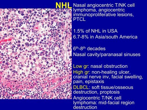 Pathology of Head and Neck Malignancies - Aroi.org