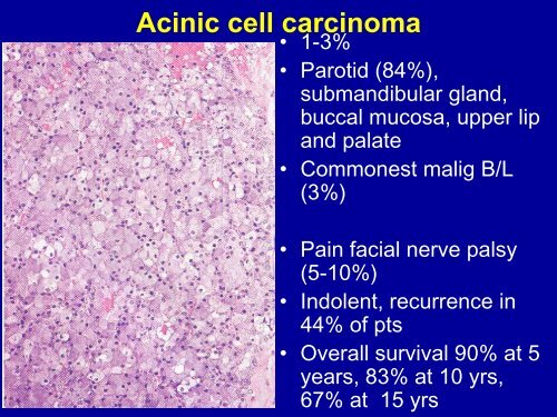 Pathology of Head and Neck Malignancies - Aroi.org