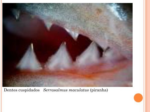 Tipos de dentes