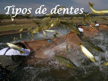 Tipos de dentes