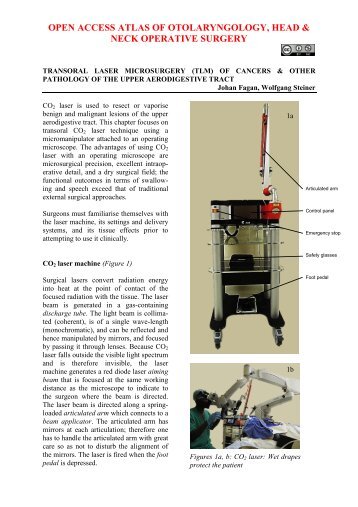 Transoral CO2 laser microsurgery (TLM) - Vula - University of Cape ...