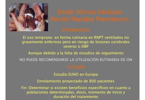 Oxido NÃ­trico Inhalado