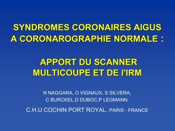 syndromes coronaires aigus a coronarographie normale : apport