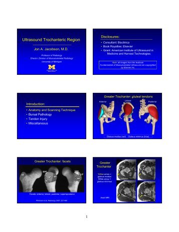 Ultrasound Trochanteric Region