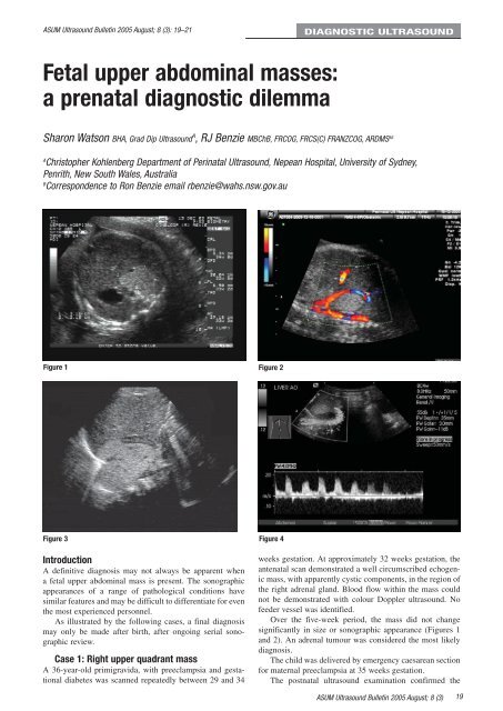 Volume 8 Issue 3 - Australasian Society for Ultrasound in Medicine