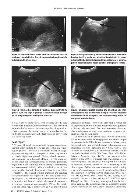 Volume 8 Issue 3 - Australasian Society for Ultrasound in Medicine