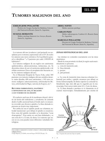 Tumores malignos del ano. - sacd.org.ar