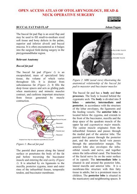 Buccal fat pad flap - Vula - University of Cape Town