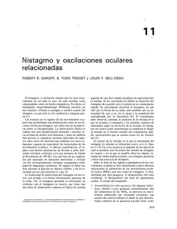 Nistagmo y oscilaciones oculares relacionadas - Omlab.org