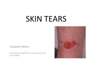 Presentation skin tears Liz