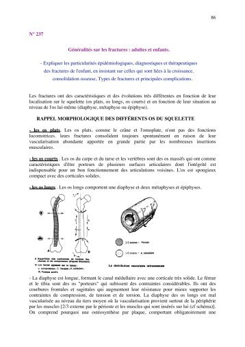 GÃ©nÃ©ralitÃ© sur les fractures : adultes et enfants