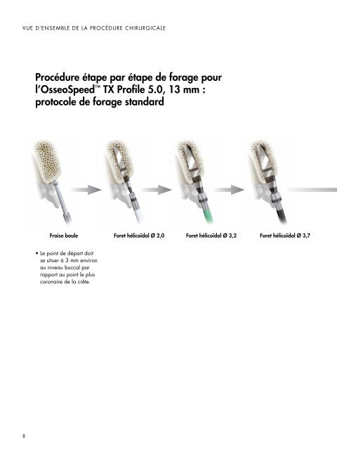 OsseoSpeedâ¢ TX Profile - Astra Tech