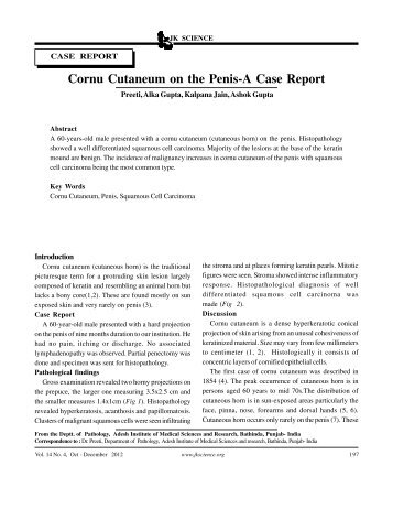 197 Cornu Cutaneum on the Penis-A Case Report - JK Science