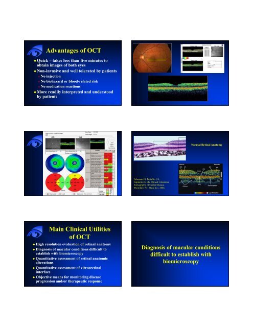 Optical Coherence Tomography (OCT)