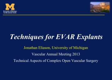 Techniques for EVAR Explants - VascularWeb