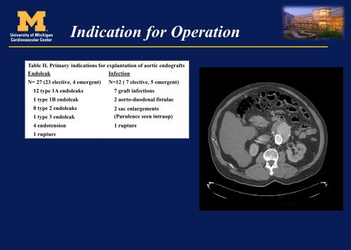 Techniques for EVAR Explants - VascularWeb