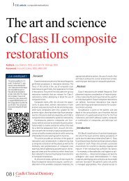 The art and science of Class II composite restorations