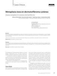 Metaplasia Ã³sea en dermatofibroma cutÃ¡neo - edigraphic.com