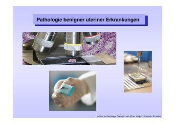 Pathologie benigner uteriner Erkrankungen - Rhein-Kreis Neuss