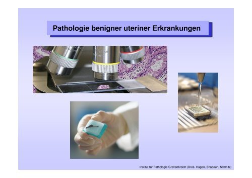 Pathologie benigner uteriner Erkrankungen - Rhein-Kreis Neuss