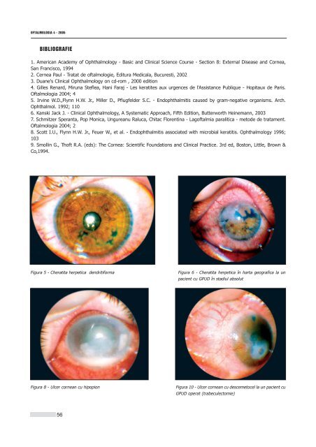 Interior 4_2005.qxd - Oftalmologia.ro