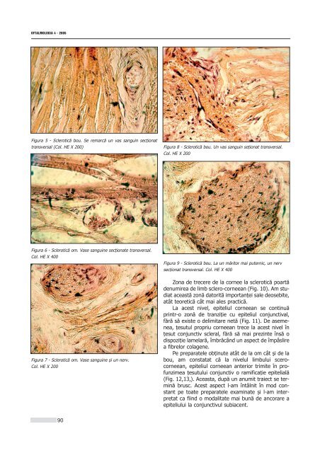 Interior 4_2005.qxd - Oftalmologia.ro