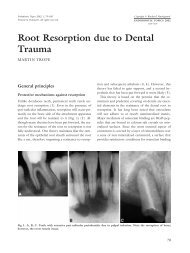 Root resorption due to dental trauma Trope EndoTopics_2002