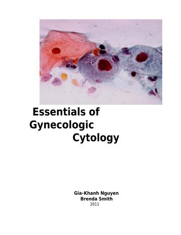 Essentials of Gynecologic Cytology - Pathology and Laboratory ...