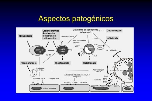 SÃ­ndromes vasculÃ­ticos riÃ±Ã³n - pulmÃ³n y hemorragia pulmonar mÃ©dica