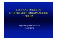 Fracture ext. sup ulna - ClubOrtho.fr