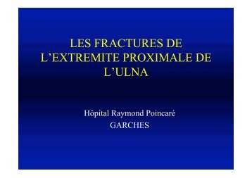 Fracture ext. sup ulna - ClubOrtho.fr
