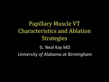 Kay-Papillary-Muscle-VT