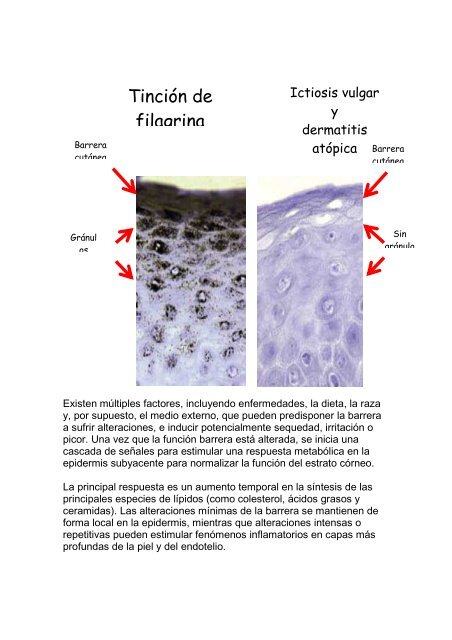 173 Filagrina y la funciÃ³n de barrera - Antonio RondÃ³n Lugo