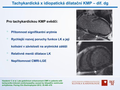 Diagnostika v arytmologii â MUDr. Dan Wichterle, Ph.D., IKEM, Praha