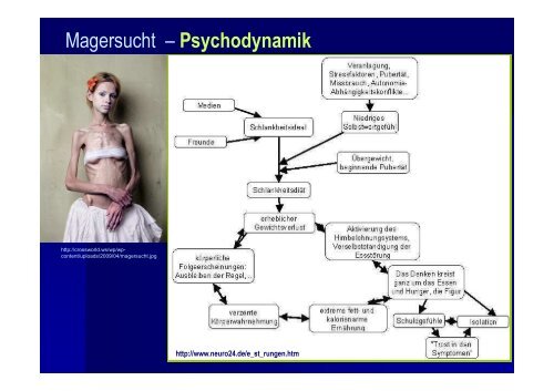 Magersucht + Ess-Brech-Sucht - Medidakta