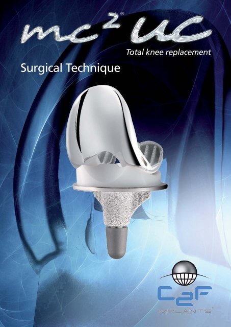 114519 ANG TO c2f MC2 UC_Mise en page 1 - c2f implants