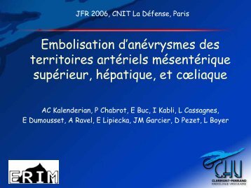 7 patients Ã©taient porteurs d'un anÃ©vrysme hÃ©patique