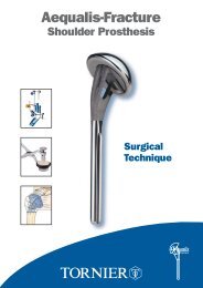 Tornier Fracture Surgical Technique