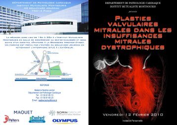 Plasties valvulaires mitrales - Fondation de l'Avenir